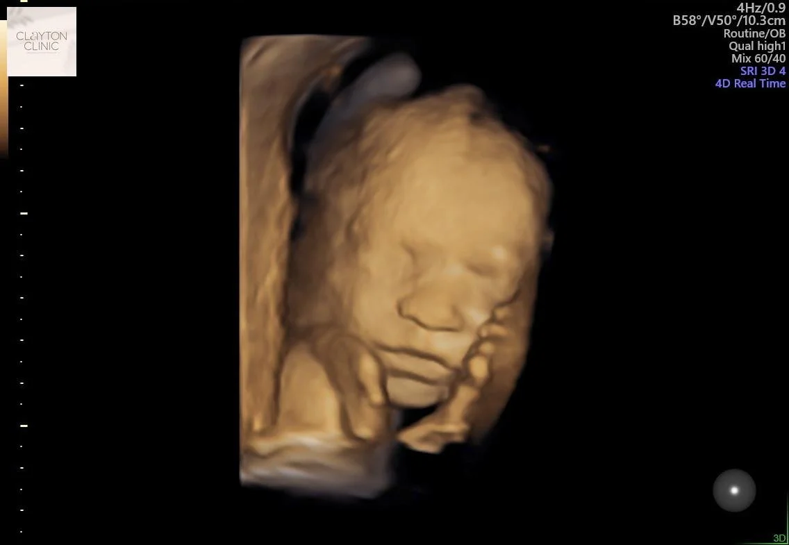 WhatsApp Image 2023-05-26 at 11.43.01.jpg