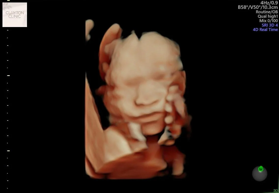 WhatsApp Image 2023-05-26 at 11.42.58.jpg