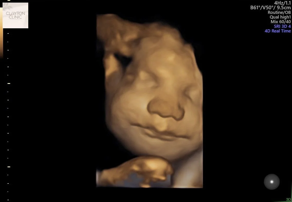 WhatsApp Image 2023-06-03 at 13.22.39.jpg