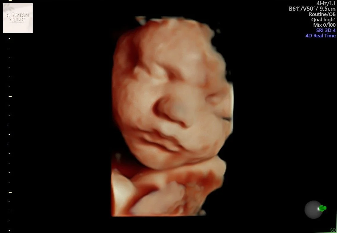 WhatsApp Image 2023-06-03 at 13.22.33.jpg