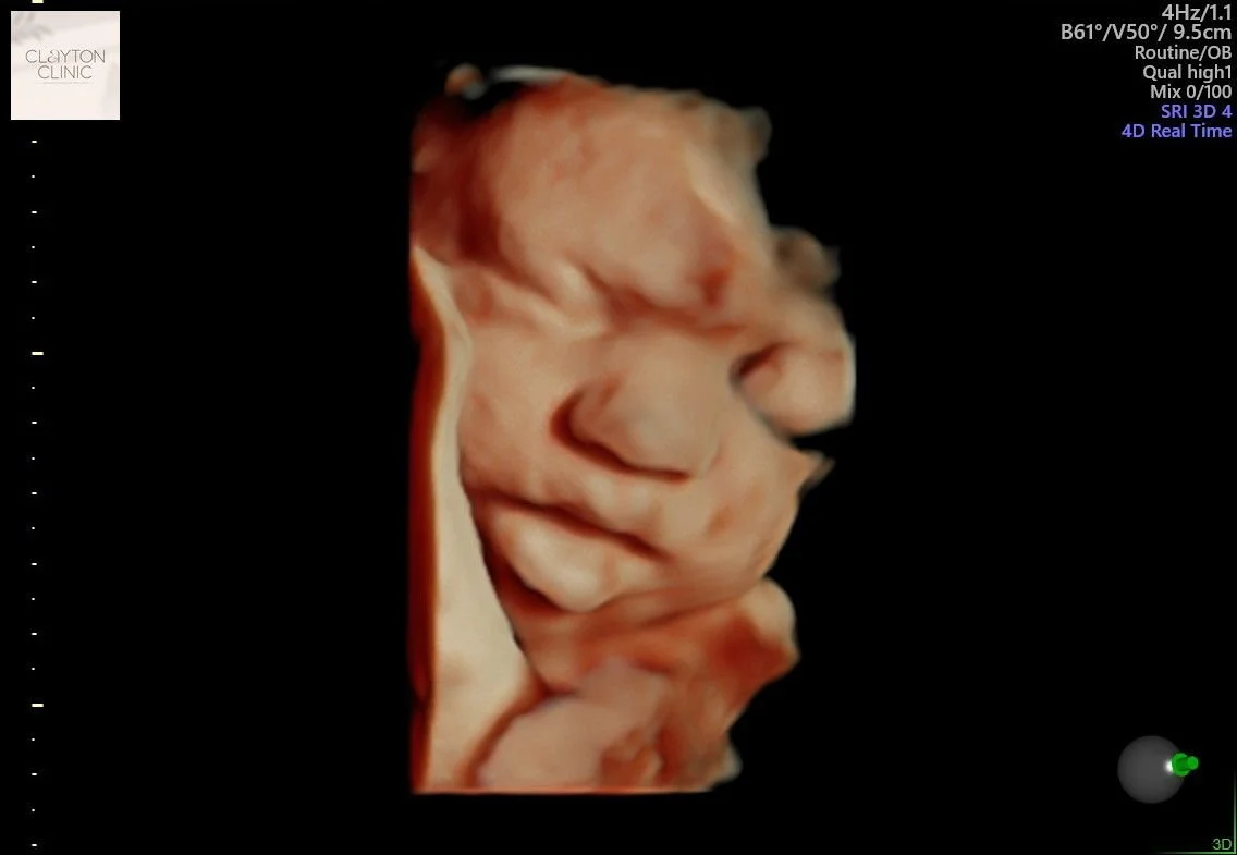 WhatsApp Image 2023-06-03 at 13.22.47.jpg