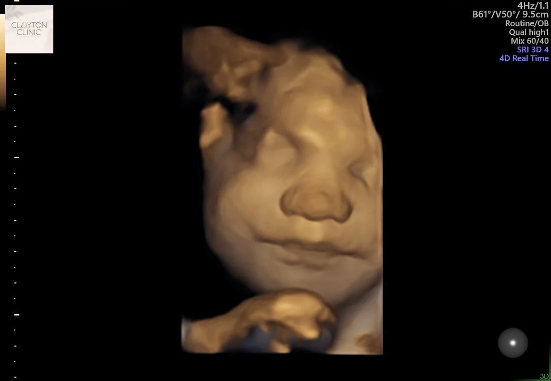 WhatsApp Image 2023-06-03 at 13.22.40.jpg