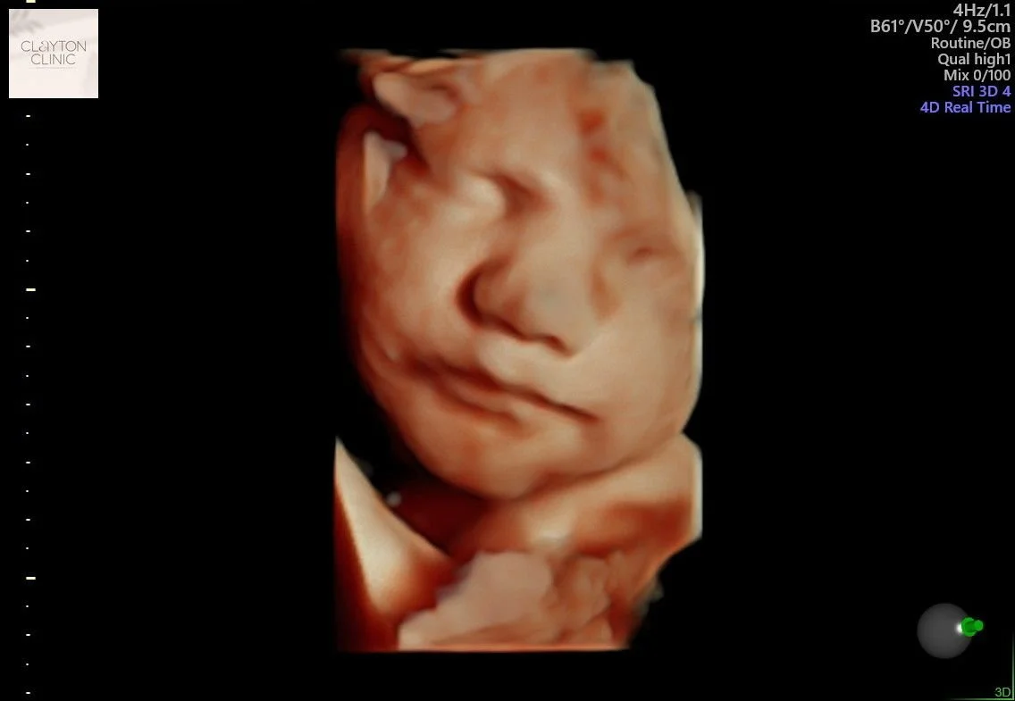 WhatsApp Image 2023-06-03 at 13.22.44.jpg