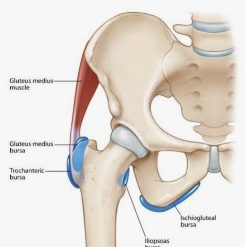 Diagram of the human pelvis muscle attachments showing gluteus medius muscle, gluteus medius bursa, trochanteric bursa, ischiogluteal bursa, and iliopsoas bursa.