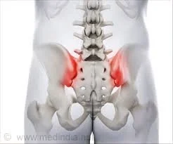 SIJ Dysfunction Treatment Central Coast | Pelvic Pain Physio — Thrive ...