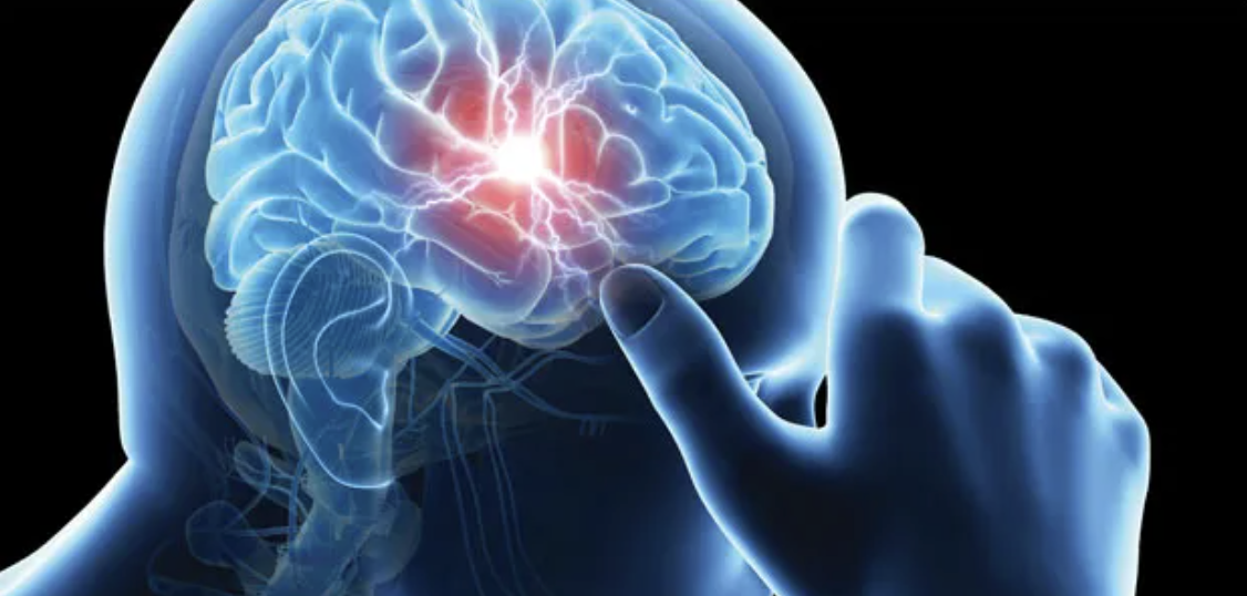 Vestibular Migraines and How Physiotherapy Can Help