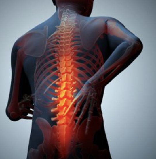 Digital illustration of a human back with the spine highlighted in red, showing spinal pain or discomfort.