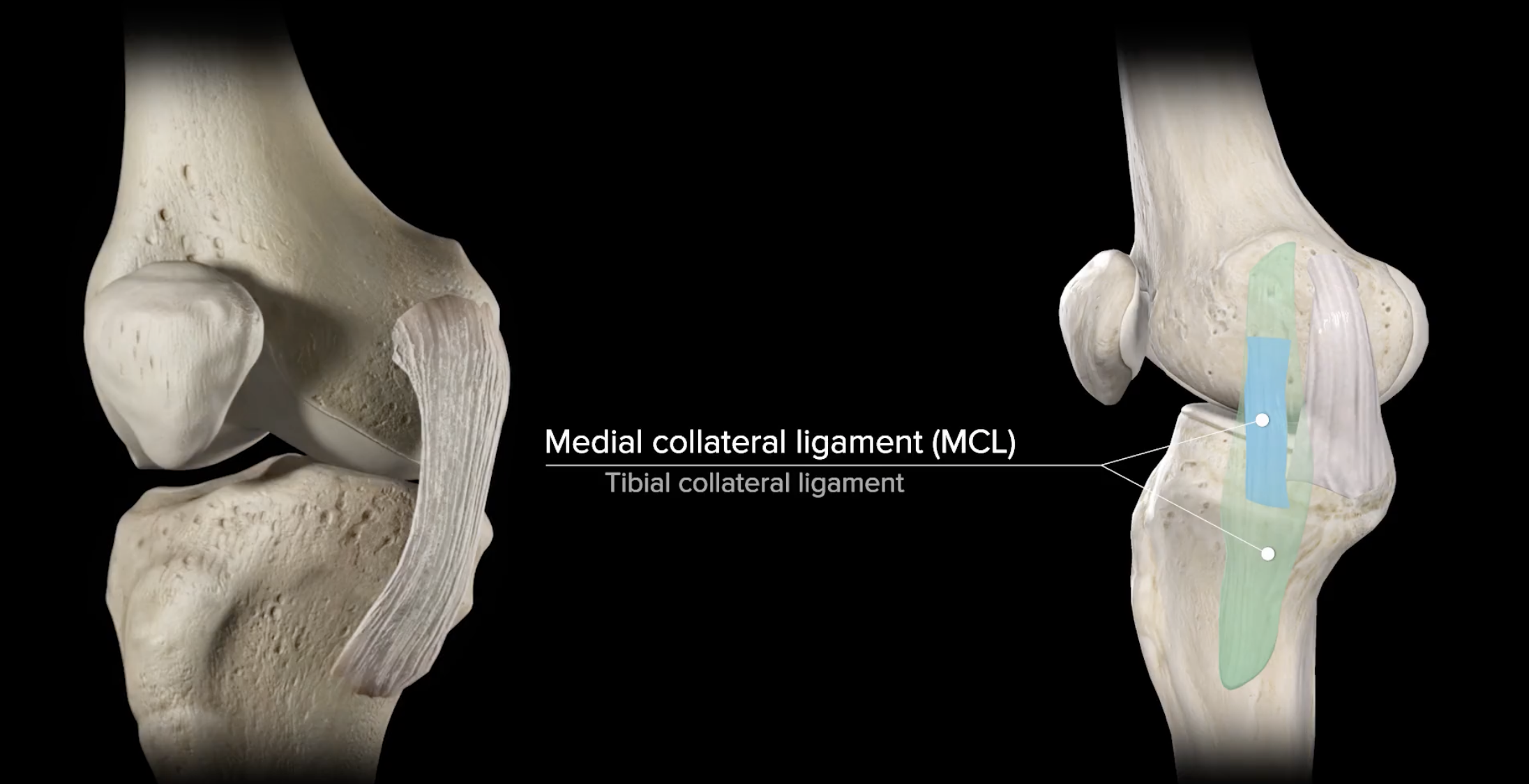 MCL Tear — Jonathan Koscso, MD