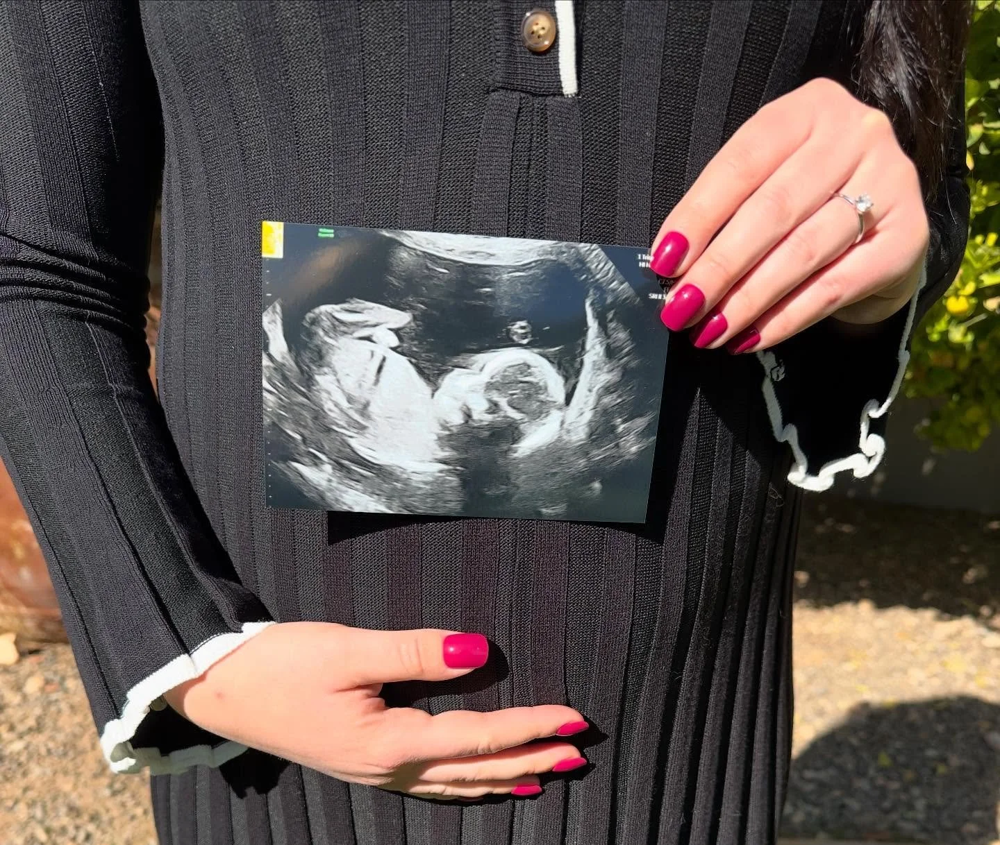 Feeling extra thankful ( &amp; hungry!!!) this year 🫶🏻

We can&rsquo;t wait to meet you in March, Baby Girl 💗💗