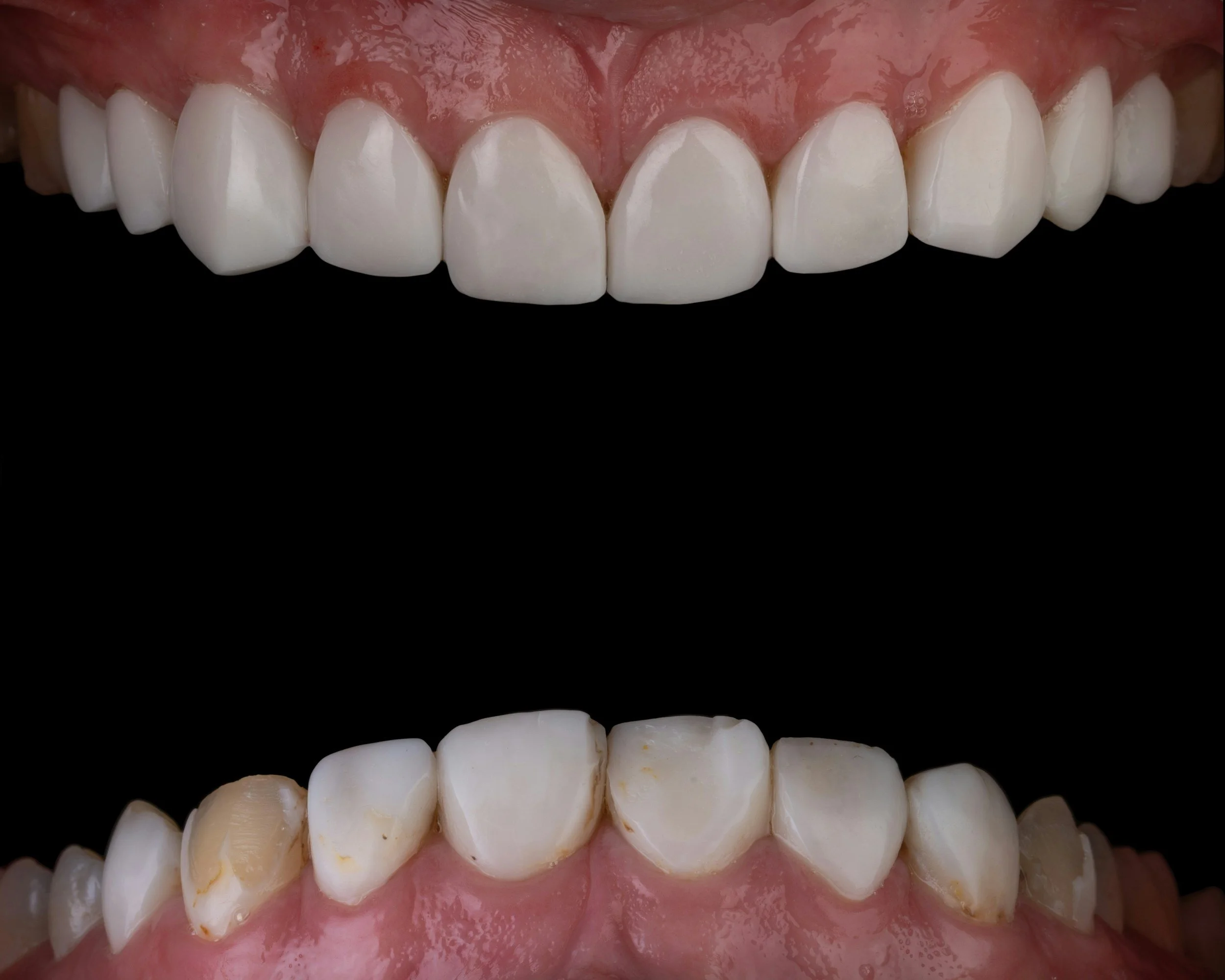 Signs of Tooth Infection &amp; When to Get Treatment Online