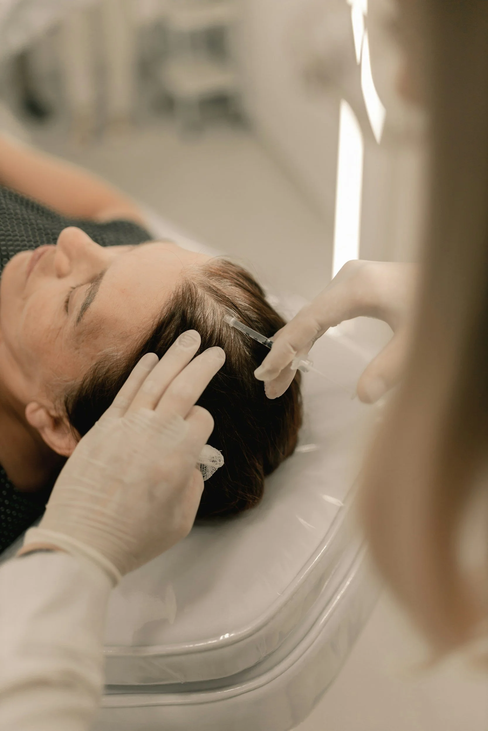 7 Things Mothers Should Know Before Considering a Hair Transplant