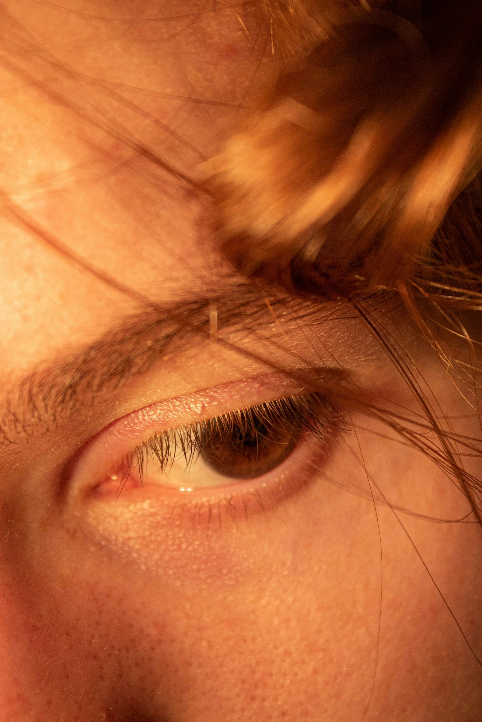 Can Droopy Eyelids Affect Your Vision? When Eyelid Surgery Is Considered&nbsp; Medical