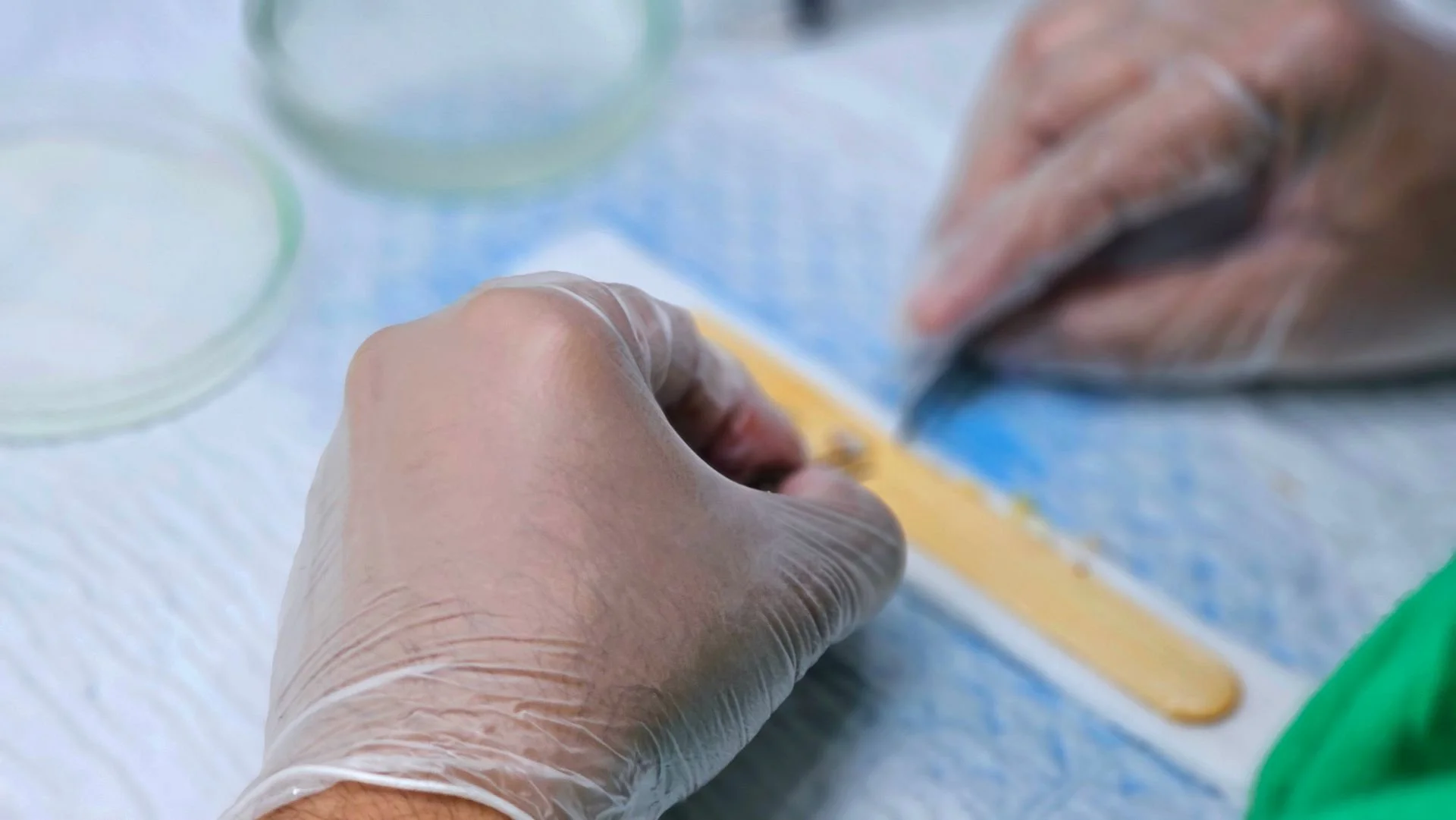 Hair Transplant Donor Area: Everything You Need to Know About Hair Loss Behind Your Head