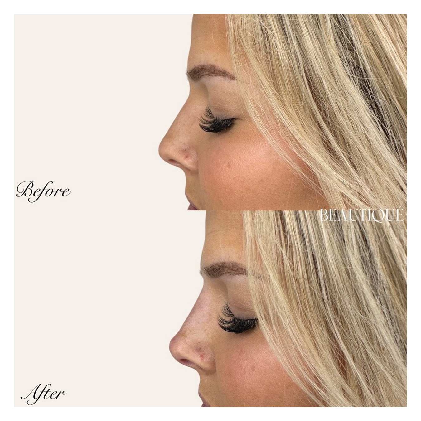 Before and afters2.png