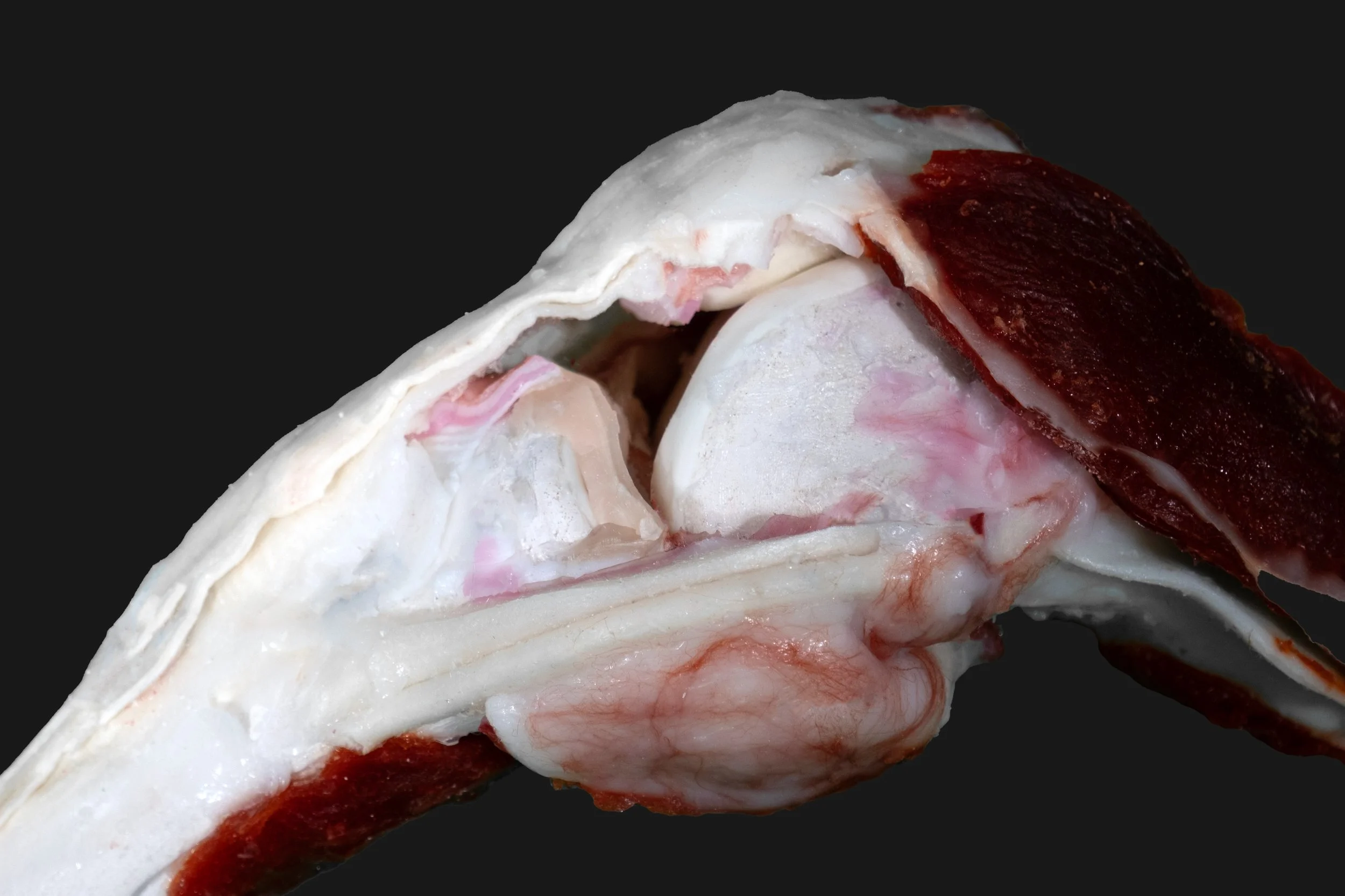 Tactile Knee Model Clinical Study Overview