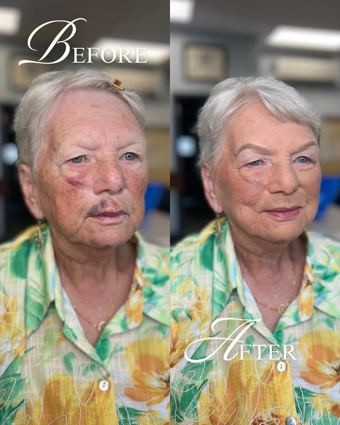 I was mid-wedding when I got an emergency call &mdash; grandma had a bad fall walking the dog and they asked if I could take care of her.

Challenge accepted.

We got grandma looking real nice and not a bruise in sight. She was glowing, confident, an