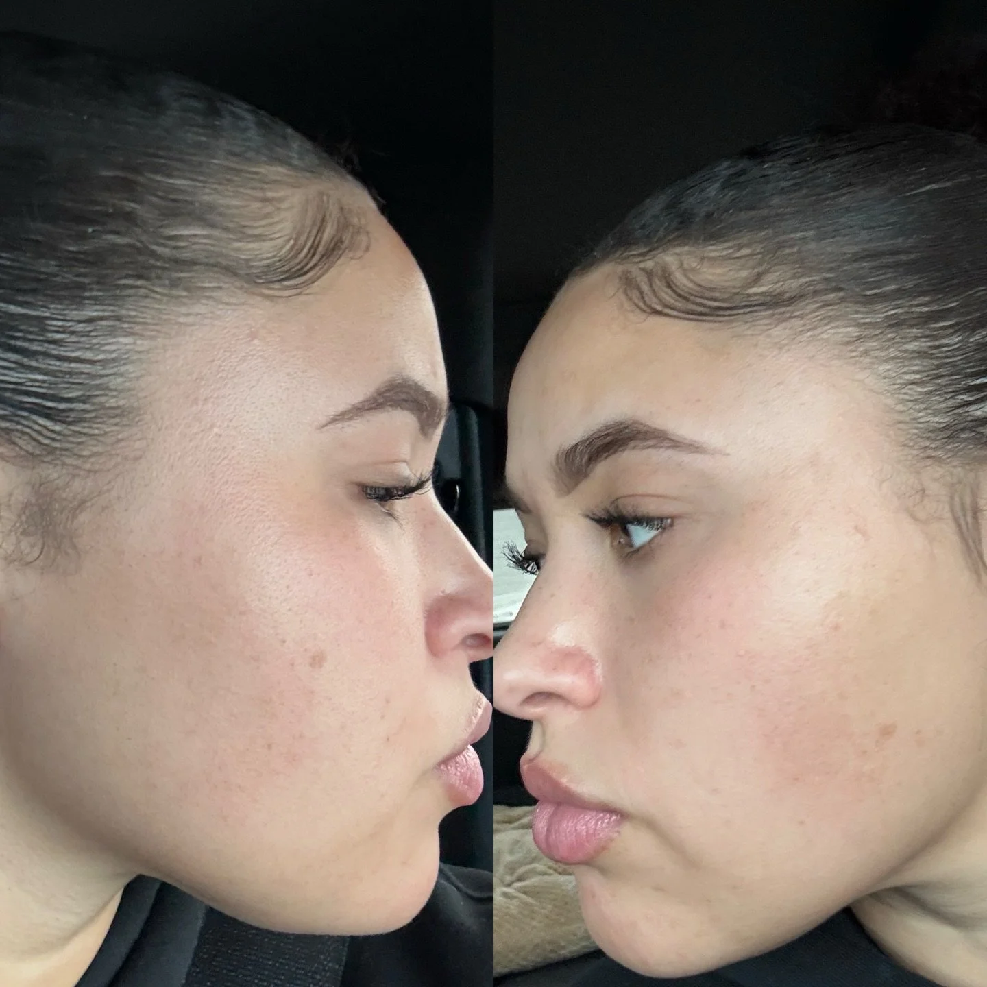 Look at my gorg glowing client 👀😏

Skin transformations are my favorite! 

#skincare #acne #facerealityskincare #acnespecialist