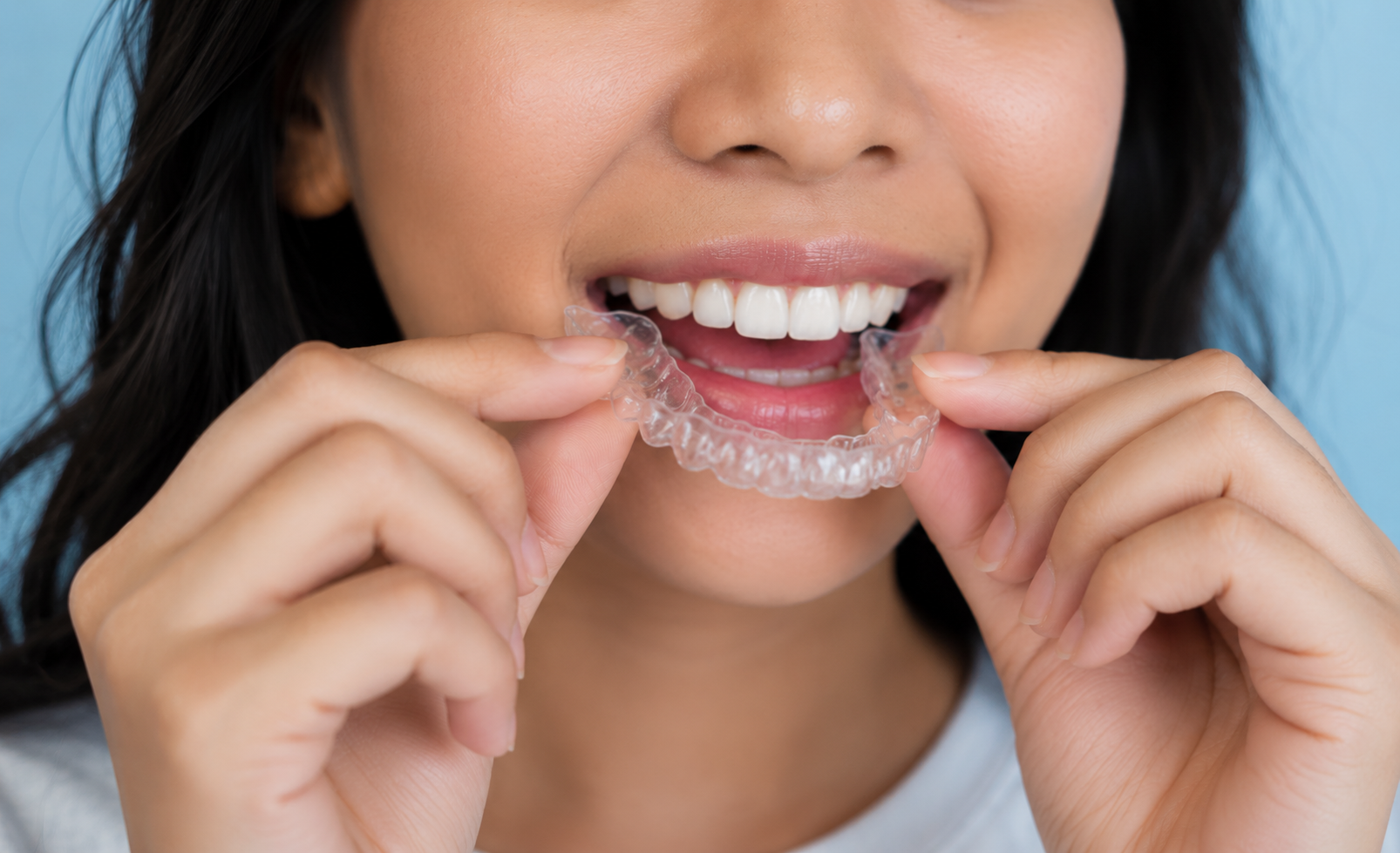 Invisalign vs Zenyum: How To Choose Between Clear Aligner Brands