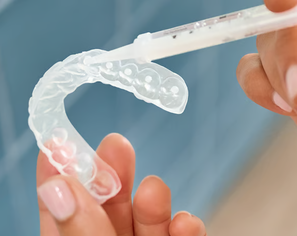Person holding a clear dental retainer or aligner while applying a liquid substance with a syringe.