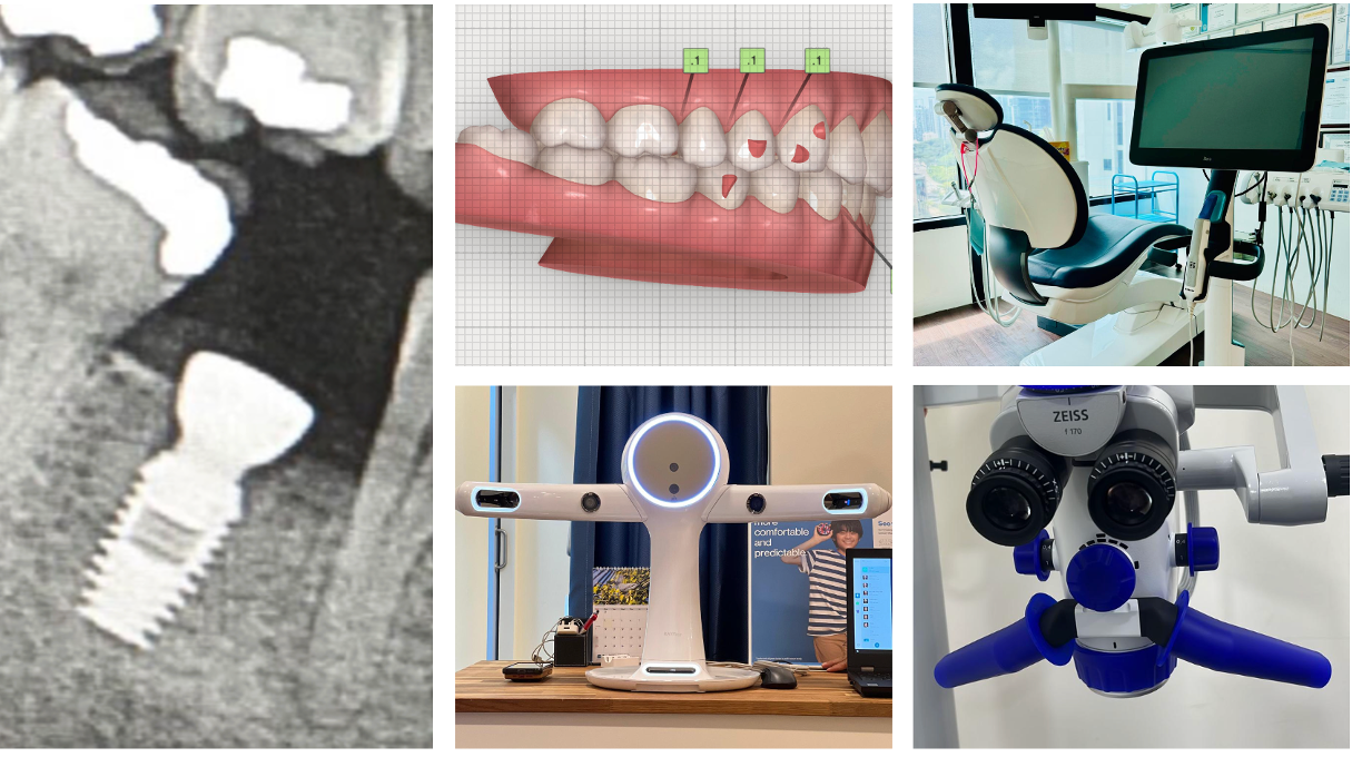 A collage of five images showing dental technology and equipment, including a dental implant screw, digital dental imaging, a dental chair with monitor, a 3D facial scanning device, and a dental microscope.