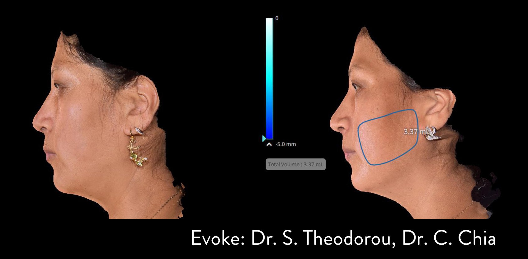 evoke-before-after-dr-theodorou-dr-chia-preview-1.jpg