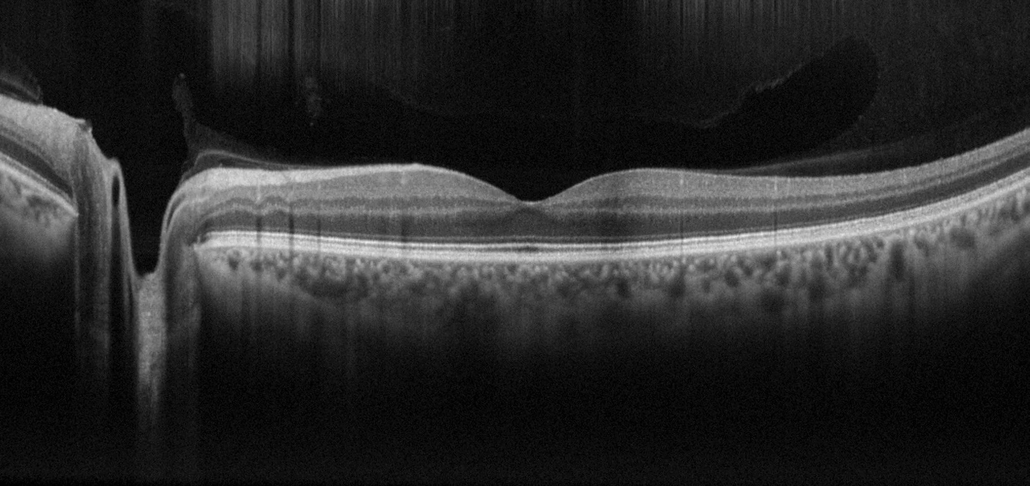 Is an advanced eye test worth it? Your Cheltenham guide to OCT and retinal scan