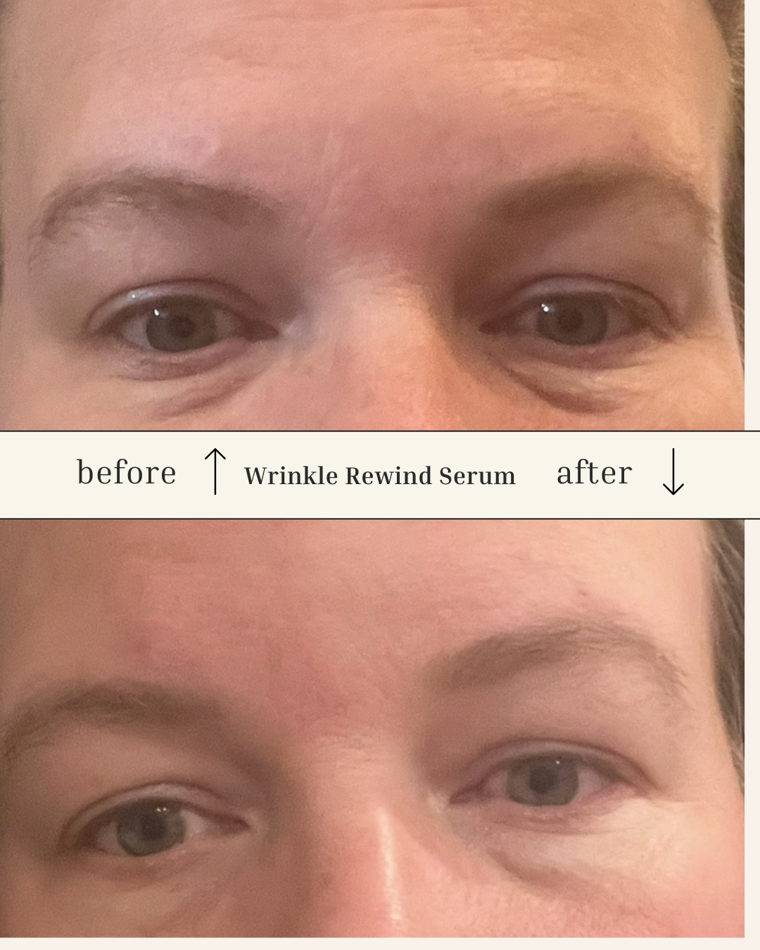 Wrinkle Rewind Serum.png