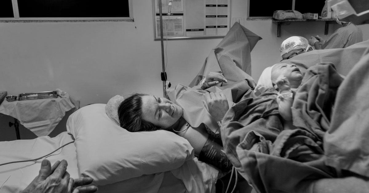 Do I Need a Doula If I Have a Planned C-Section?