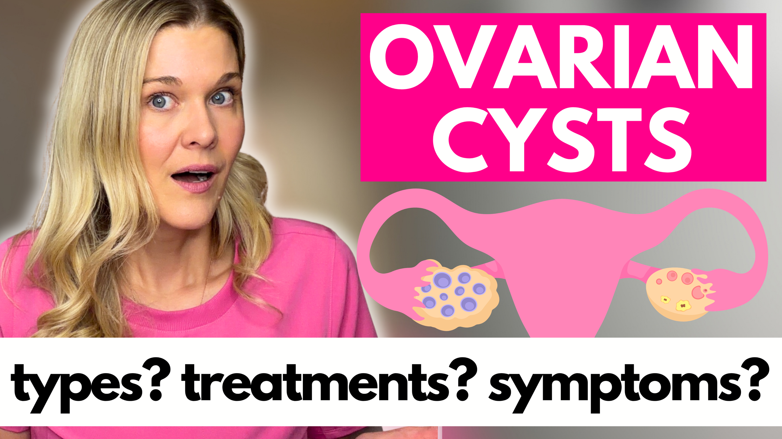 Ovarian Cysts: Types, Symptoms, and Treatment Options