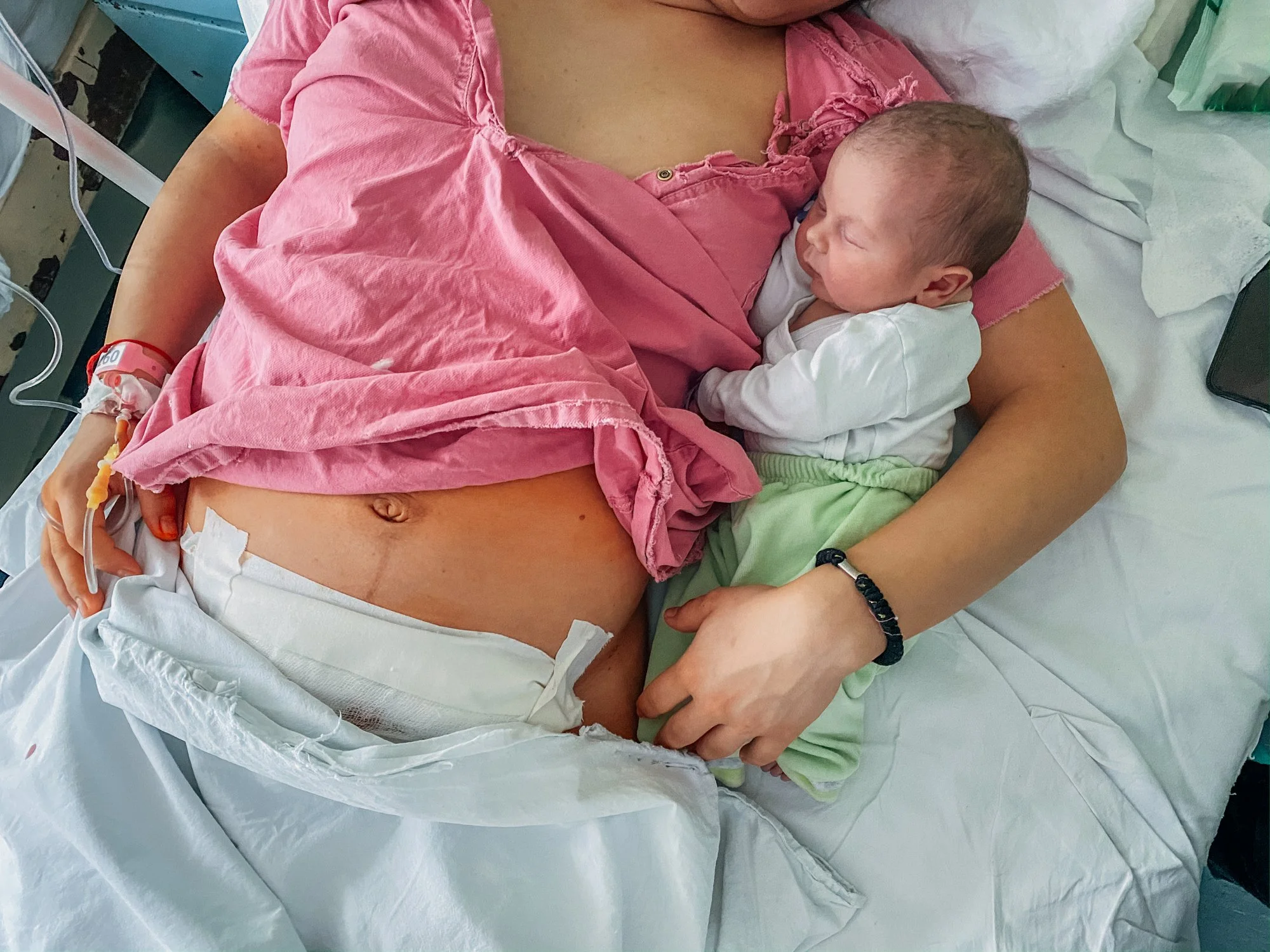C-Section Recovery Tips from a Pelvic Floor Physical Therapist 