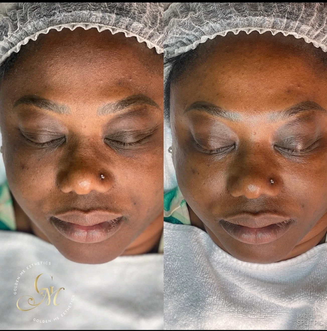 Facials are more than relaxation&mdash;they&rsquo;re targeted treatments that combat dryness, revive dull skin, and restore balance for a healthier, radiant complexion. ✨
&bull;
&bull;
#GlowUp #SelfCareGoals #FacialFriday #SkinCareRoutine #SkinCareTi