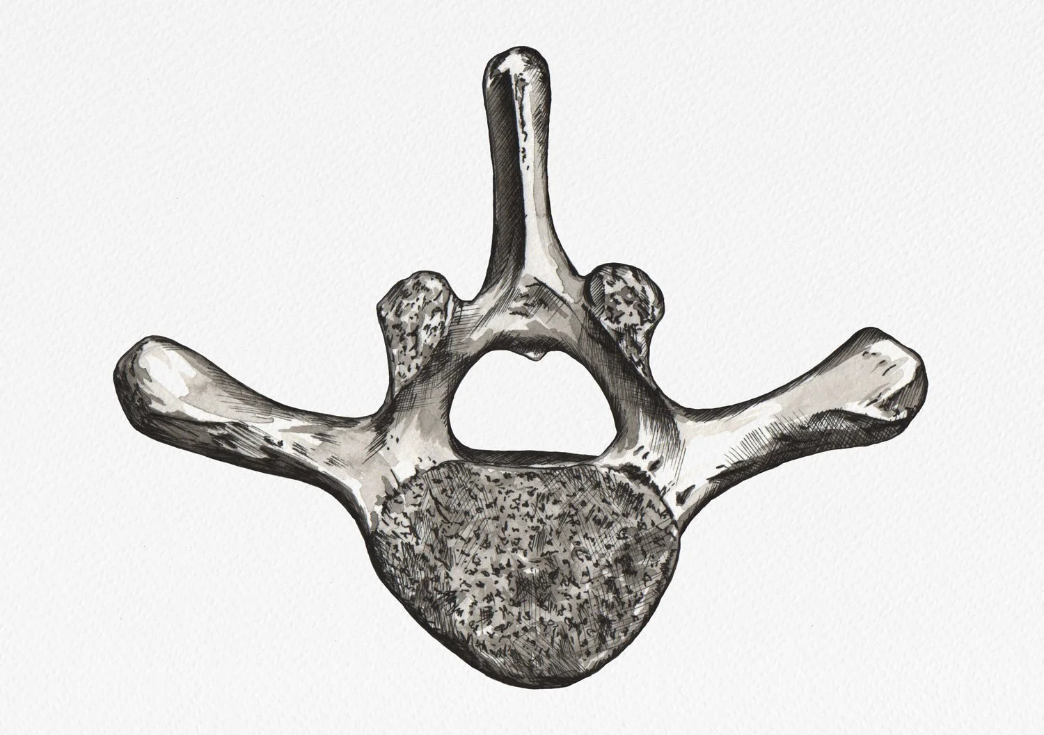A black and white illustration of a vertebra with a circular hole in the center and five protruding processes.