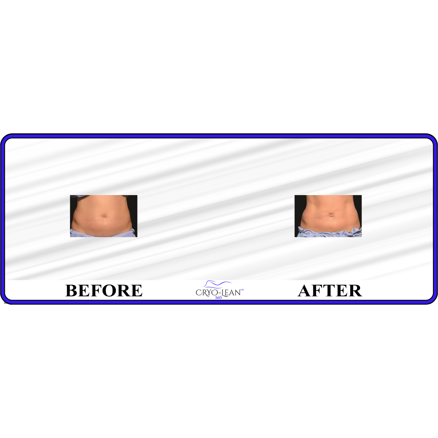 Before After Toning stomach abs.png