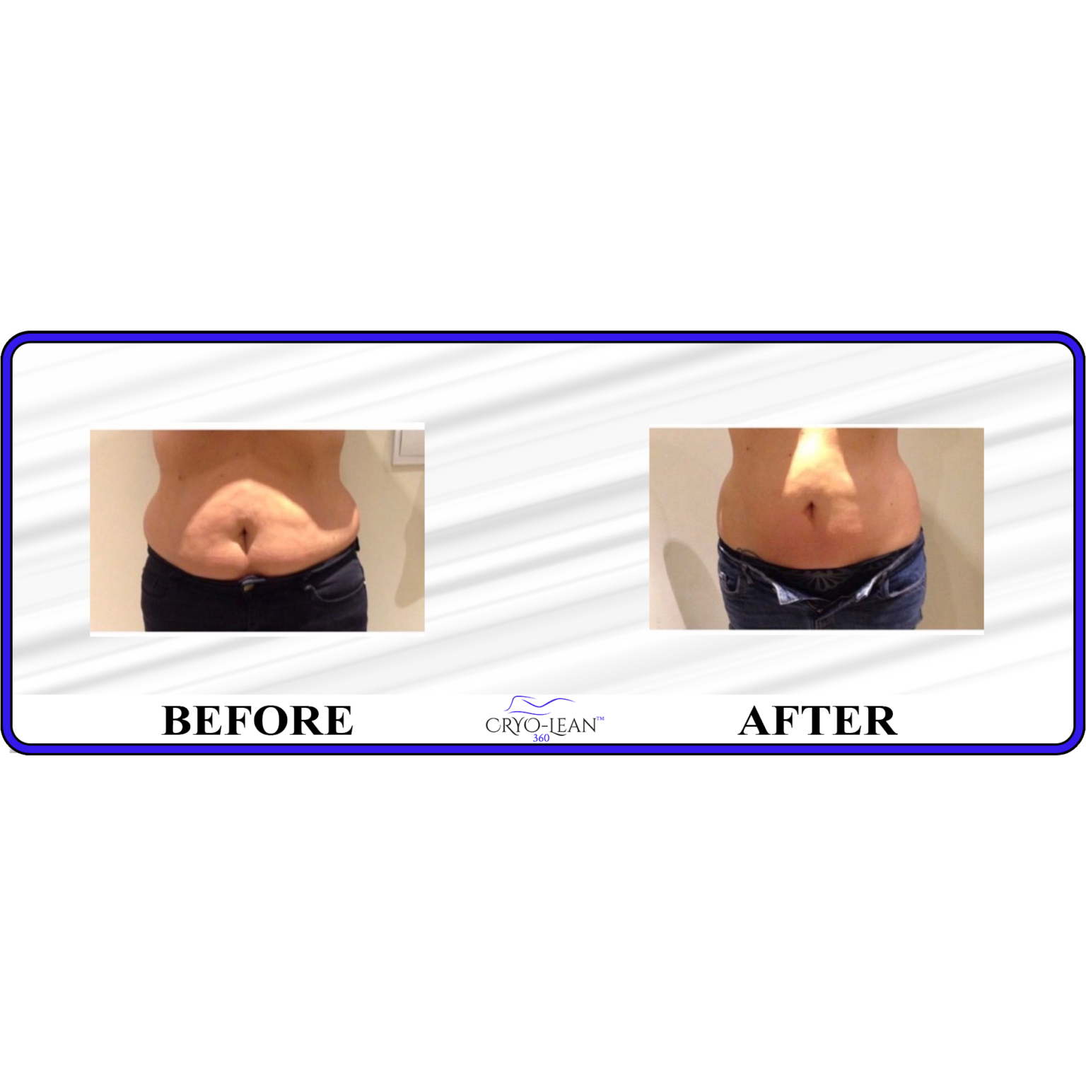 Before After stomach toning.png