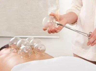 Schröpfen - so hilfreich für die Therapie