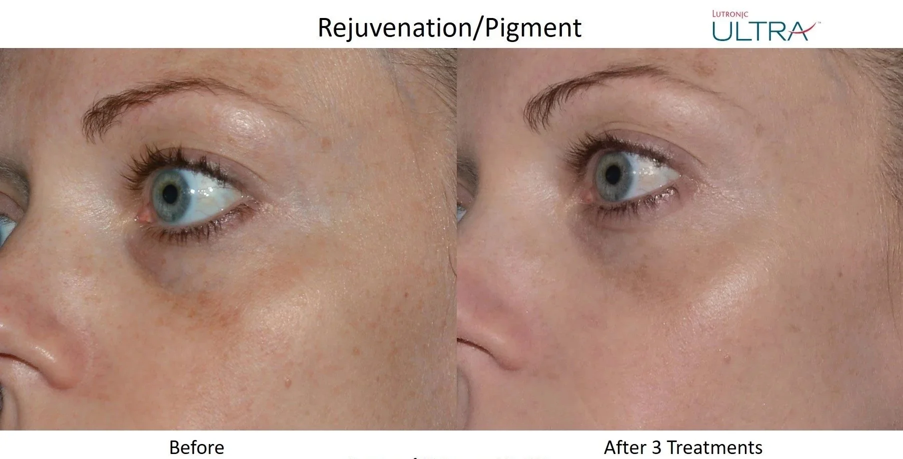 Ultra+Loverme+Rejuvenation+Pigment+9.jpg