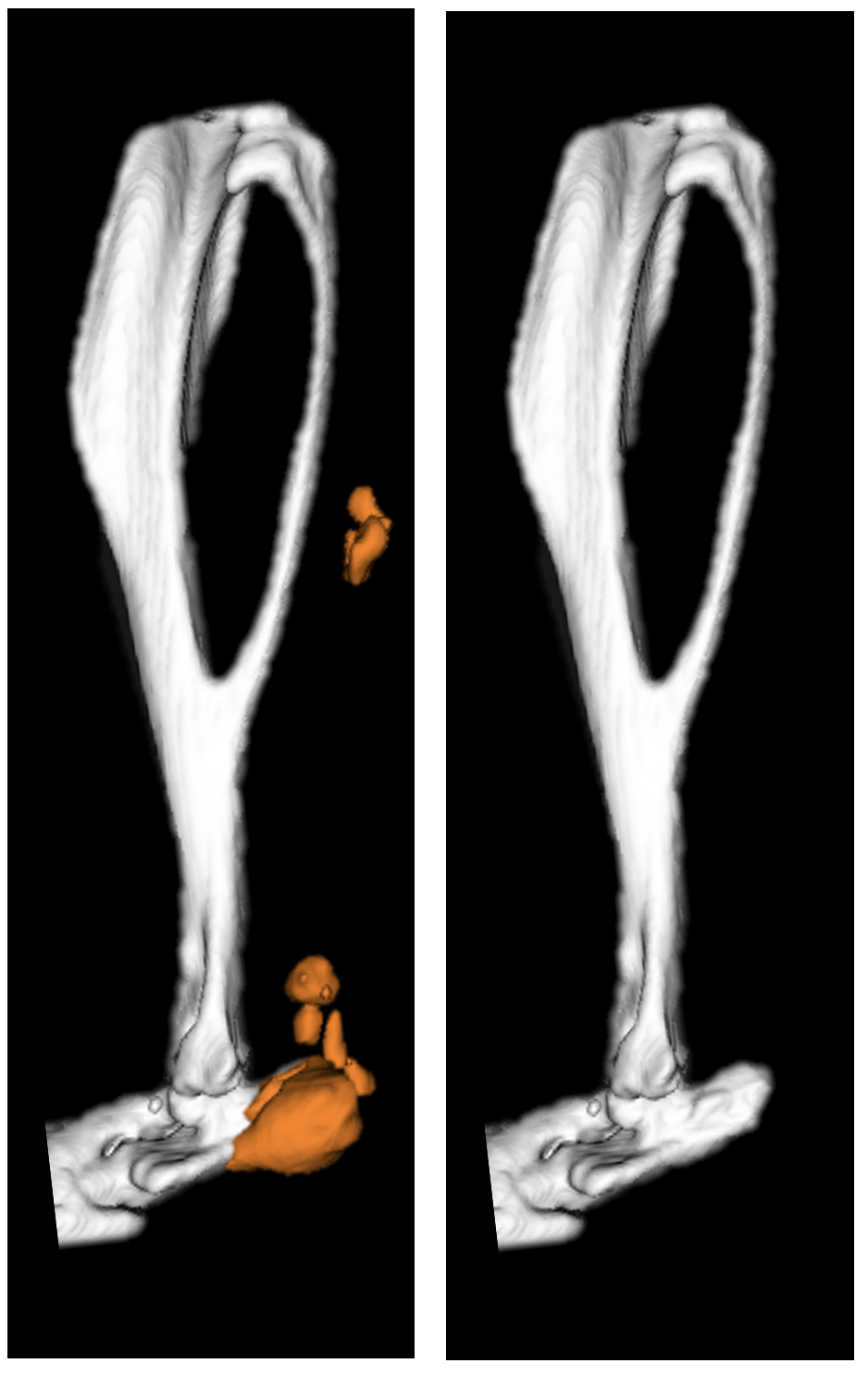 Mouse hindlimb uCT: Levi Lab has generated a mouse model that reliably and reproducibly replicates the formation of human traumatic heterotopic ossification allowing for in vivo studies of the debilitating disease