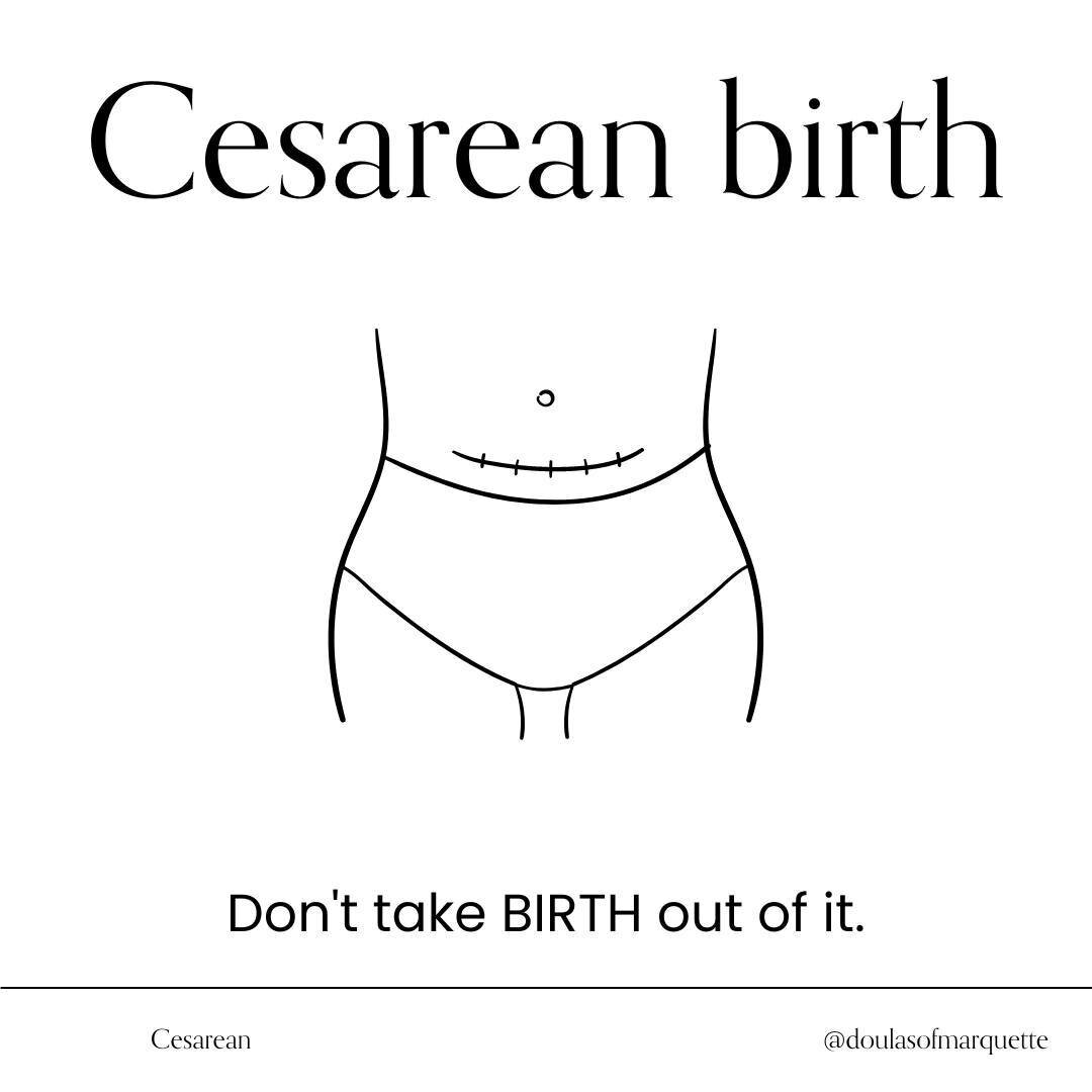 Expecting parents can arrive at a cesarean birth in a variety of different ways. Whether it's medically indicated (such as in the case of placenta previa), unexpectedly during labor (often after a long labor where all options are exhausted), by their