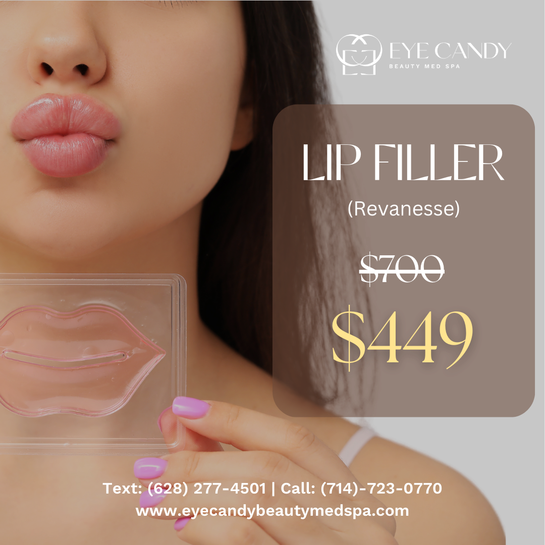 lip filler.png