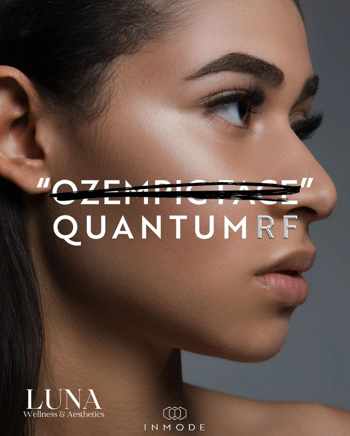 ✨ Lost weight but noticing changes in your skin? Rapid weight loss can sometimes lead to sagging or hollowing &mdash; often called &ldquo;Ozempic face.&rdquo;

Our QuantumRF treatment uses radiofrequency + microneedling to tighten, lift, and rebuild 
