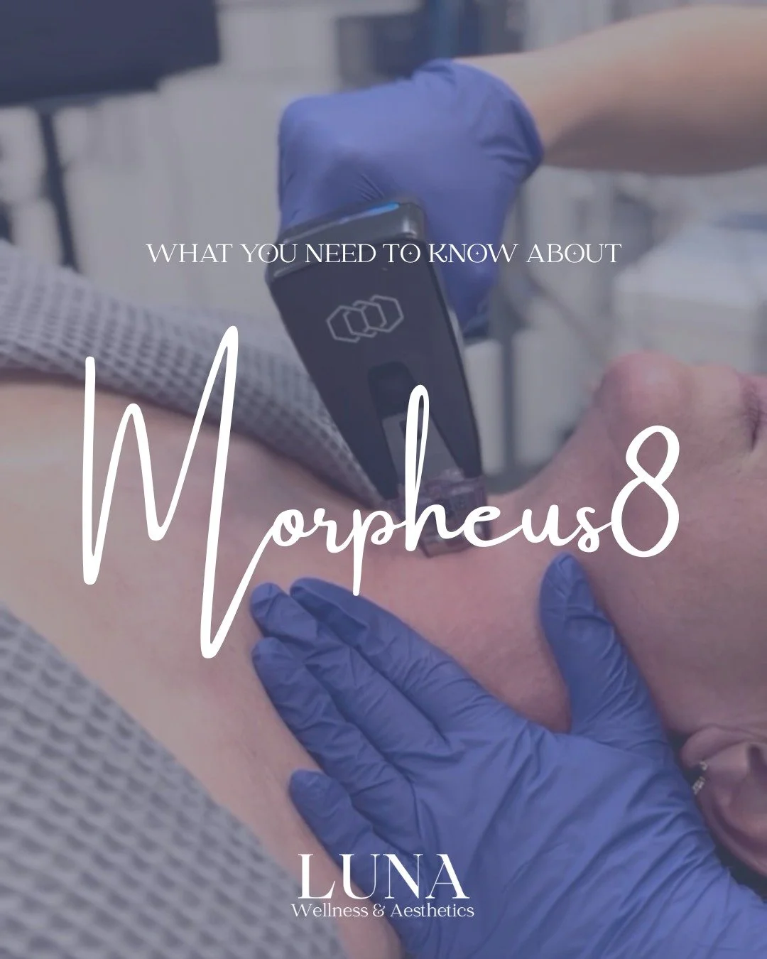 ✨ What you need to know about Morpheus8 ✨

Morpheus8 is one of the most advanced, non-surgical treatments available today for skin tightening and rejuvenation. It combines microneedling with radiofrequency energy, targeting the deeper layers of your 