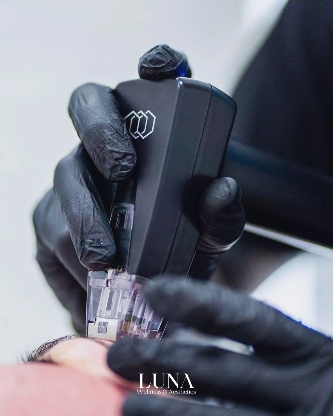 It&rsquo;s time to tighten, tone, and transform 🔥 Morpheus8 is a game-changer in skin rejuvenation, targeting deep layers to lift, smooth, and contour the face or body. One treatment can deliver dramatic, long-lasting results.
💳 Financing options a