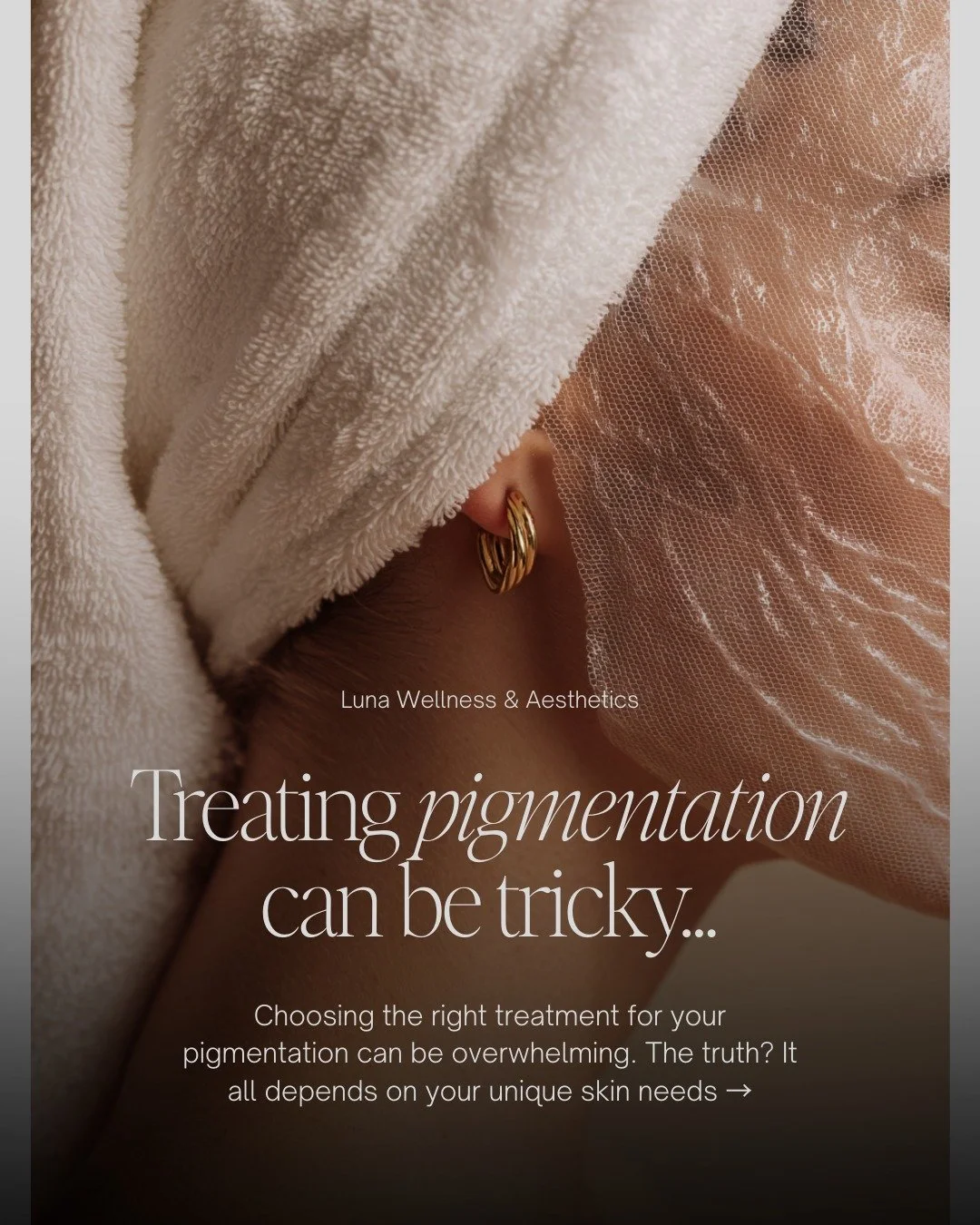 Pigmentation isn&rsquo;t one-size-fits-all ✨

Some concerns can be treated with medical-grade skincare, others respond best to chemical peels, and some require advanced laser treatments &mdash; and at Luna Wellness &amp; Aesthetics, we offer all of t