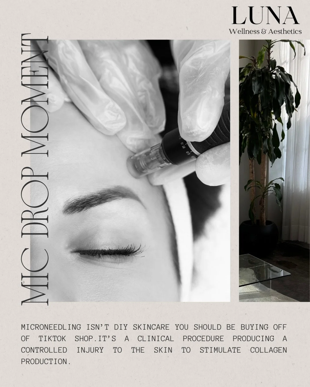 Social media makes microneedling look deceptively simple.

And I get it. The appeal of a "professional grade" skin pen done in the privacy and convenience of your own home at a fraction of the cost makes sense.

But what doesn&rsquo;t make 