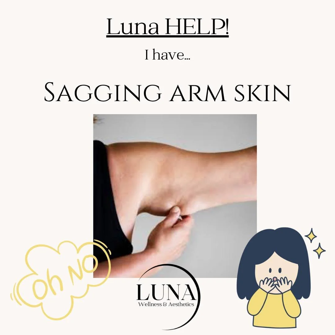 ✨ Bye bye &ldquo;bat wings&rdquo; 👋✨

Loose, crepey, sagging arm skin is one of the MOST common concerns we hear at Luna &mdash; especially after weight loss, aging, or simply loss of collagen over time.

The good news? You do NOT always need surger