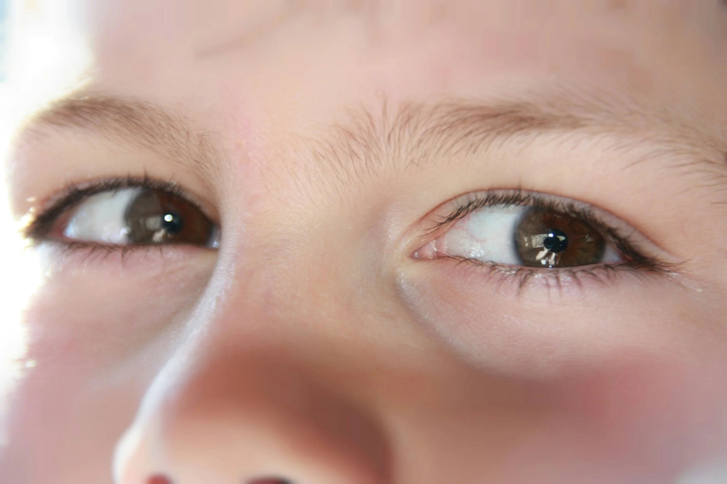 What is myopia and why is it becoming more common in children?