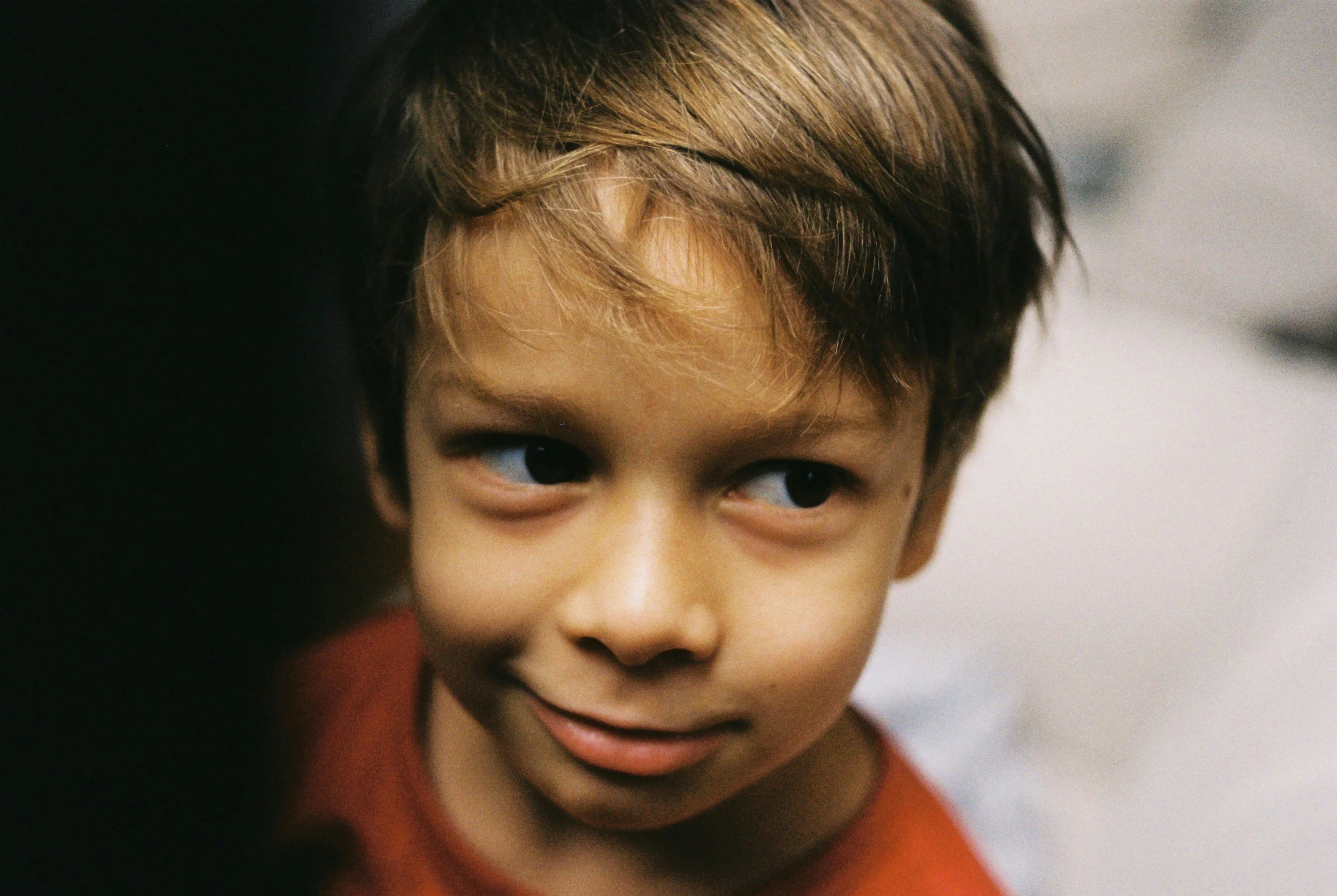 What causes crossed eyes (strabismus) in children?