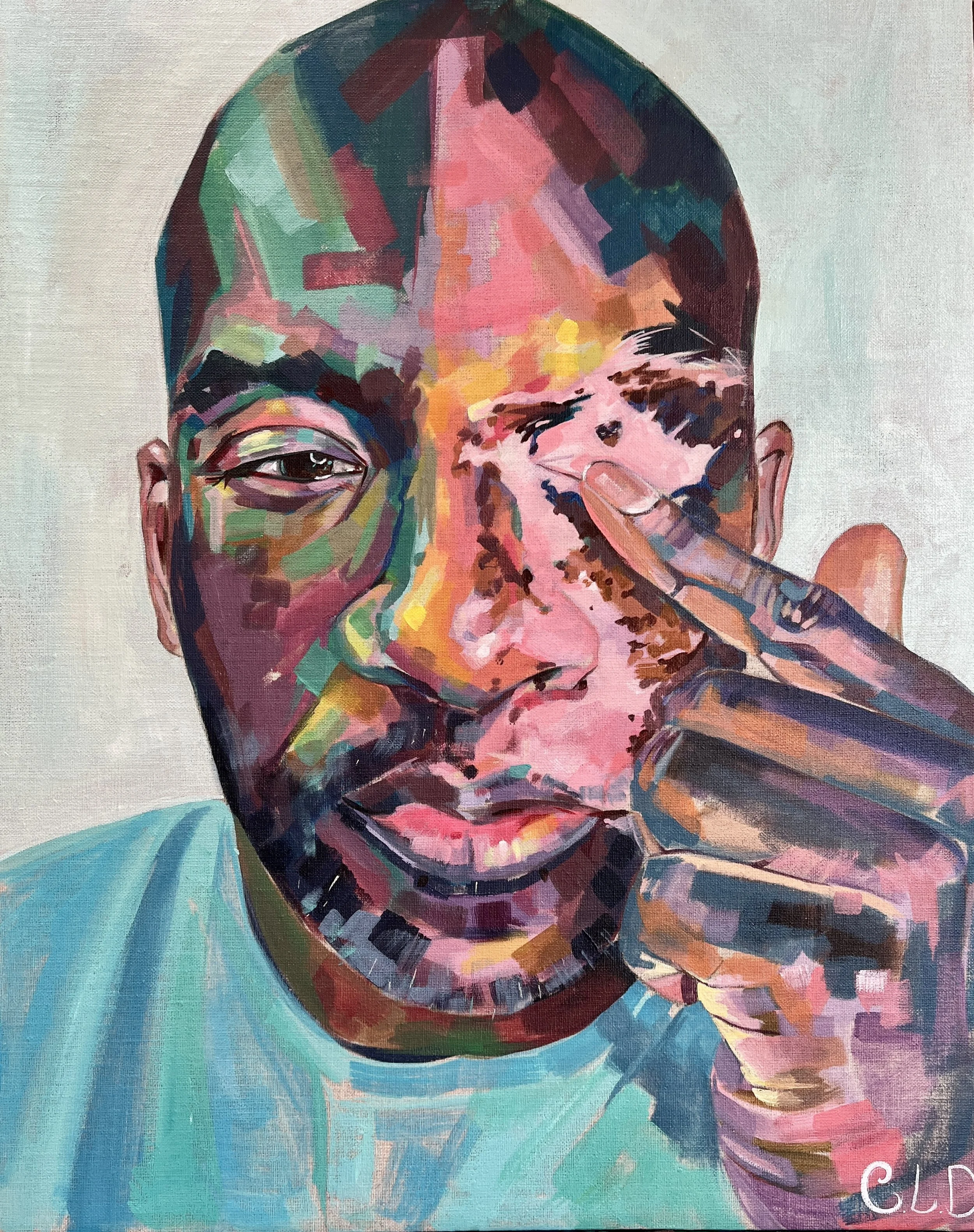 'My Mini Heart'. 3/12/24. Acrylic and oils on 16" x 20" linen canvas board. Portrait of @thatvitiligoguy SOLD 