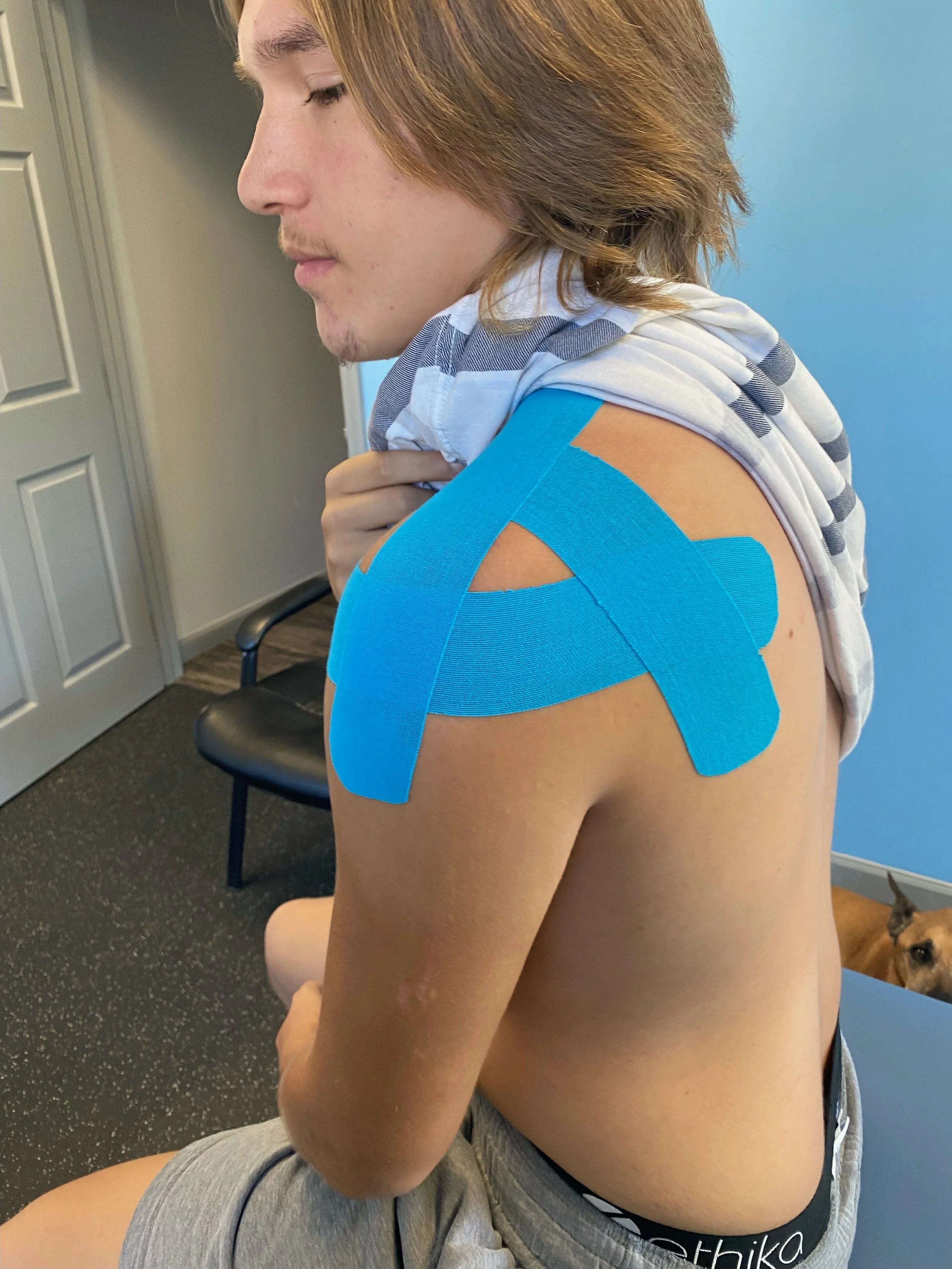 High school football player with taping to help regain stability/decrease pain following a shoulder sublux from contact.
