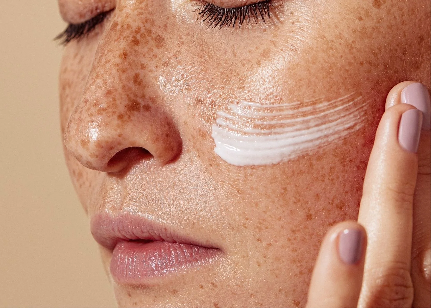 laser treatment for large pores